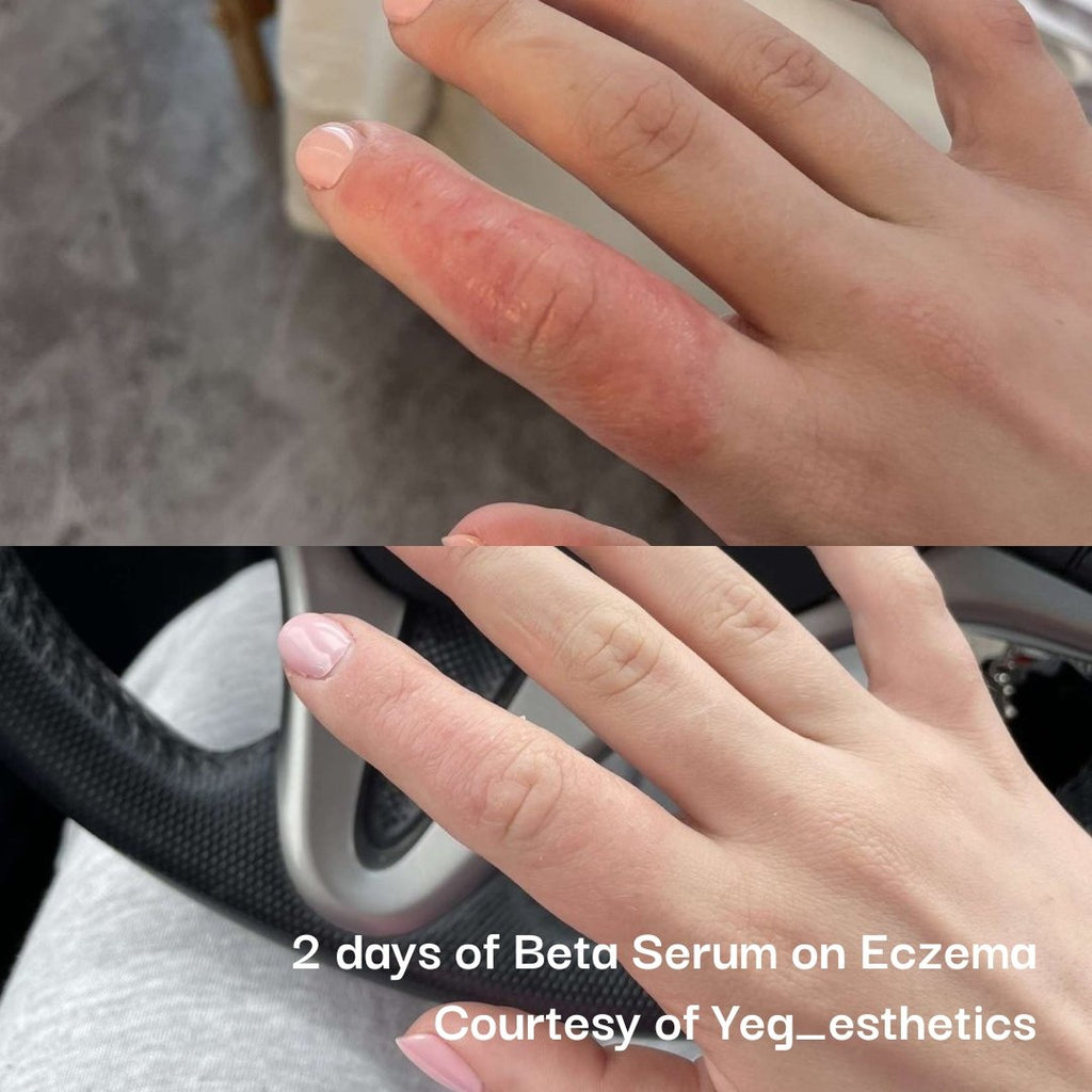 Beta Serum