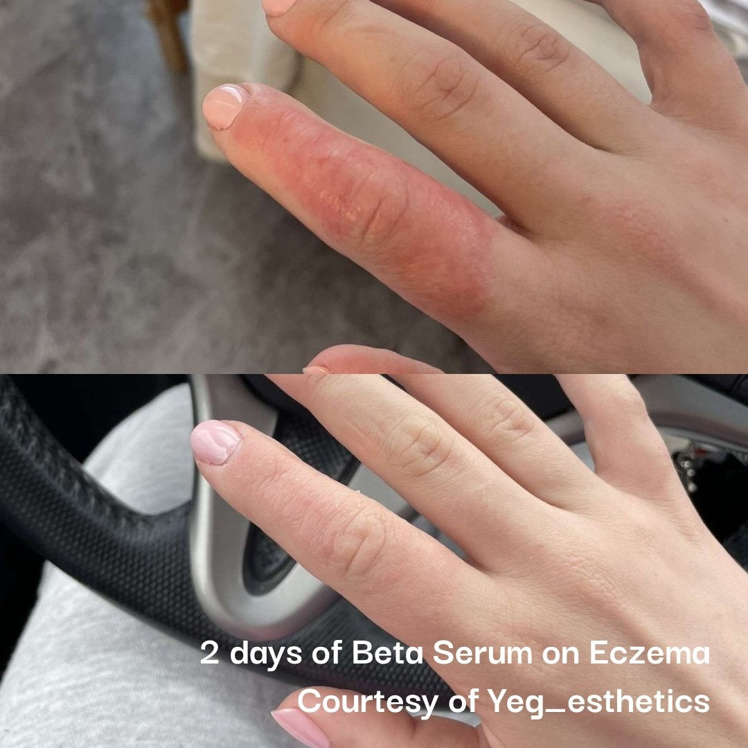 Beta Serum